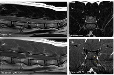 Case Report: Intramedullary Intervertebral Disk Extrusion in a Cat: Clinical, Computed Tomographic, High-Field Magnetic Resonance Imaging, and Outcome Findings